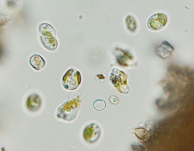 multiple golden alga cells