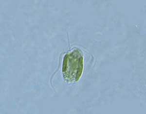 microscopic image of golden alga cel